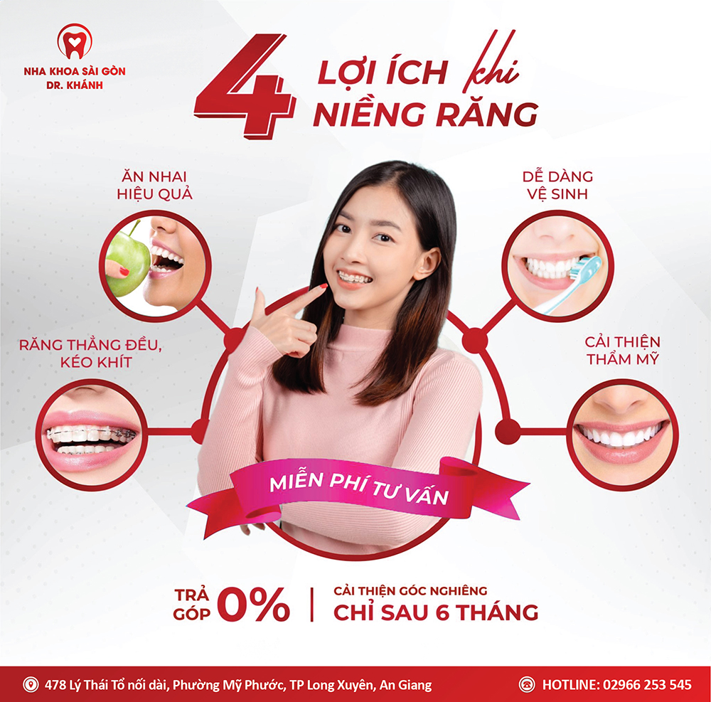 4 LỢI ÍCH KHI NIỀNG RĂNG TẠI NHA KHOA SÀI GÒN - DR KHÁNH